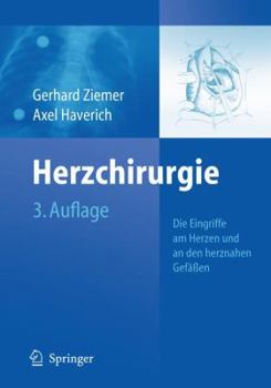 Herzchirurgie: Die Eingriffe Am Herzen Und an Den Herznahen Gefassen