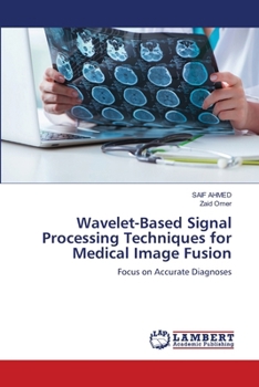 Wavelet-Based Signal Processing Techniques for Medical Image Fusion