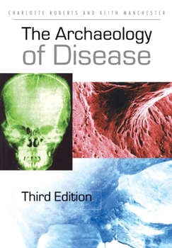 Paperback The Archaeology of Disease Book
