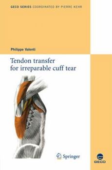 Paperback Tendon Transfer for Irreparable Cuff Tear Book