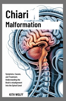 Chiari Malformation: Symptoms, Causes, and Treatment, Understanding the Brain’s Misalignment into the Spinal Canal