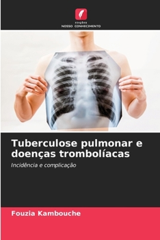 Paperback Tuberculose pulmonar e doenças trombolíacas [Portuguese] Book