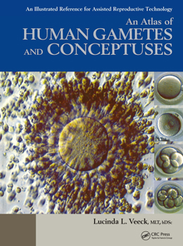 Hardcover An Atlas of Human Gametes and Conceptuses: An Illustrated Reference for Assisted Reproductive Technology Book