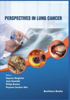 Paperback Perspectives in Lung Cancer Book