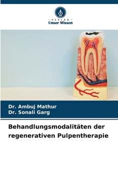 Behandlungsmodalitäten der regenerativen Pulpentherapie (German Edition)