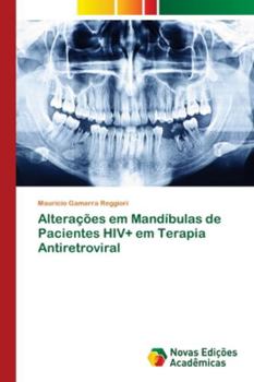 Paperback Alterações em Mandíbulas de Pacientes HIV+ em Terapia Antiretroviral [Portuguese] Book
