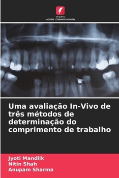 Paperback Uma avaliação In-Vivo de três métodos de determinação do comprimento de trabalho [Portuguese] Book