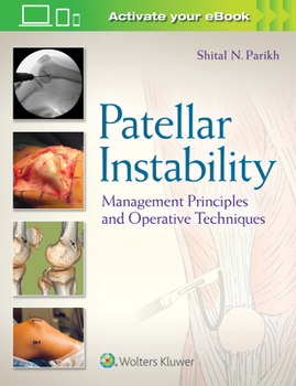 Hardcover Patellar Instability: Management Principles and Operative Techniques Book