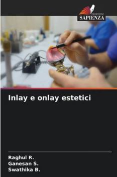 Inlay e onlay estetici (Italian Edition)