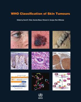 Paperback Who Classification of Skin Tumours [Op] Book