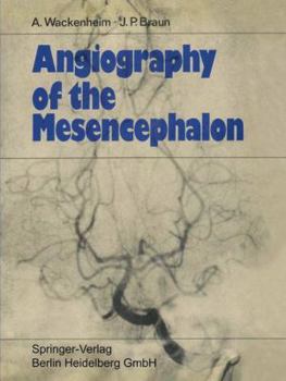 Paperback Angiography of the Mesencephalon: Normal and Pathological Findings [German] Book