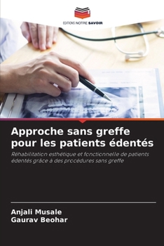 Paperback Approche sans greffe pour les patients édentés [French] Book