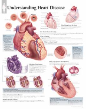 Paperback Understanding Heart Disease Chart: Wall Chart Book