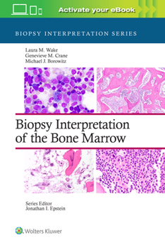 Hardcover Biopsy Interpretation of the Bone Marrow: Print + eBook with Multimedia Book