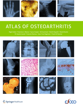 Paperback Atlas of Osteoarthritis Book