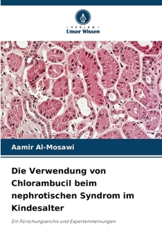 Die Verwendung von Chlorambucil beim nephrotischen Syndrom im Kindesalter (German Edition)