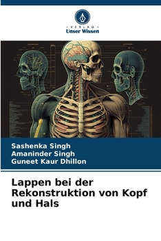 Paperback Lappen bei der Rekonstruktion von Kopf und Hals [German] Book