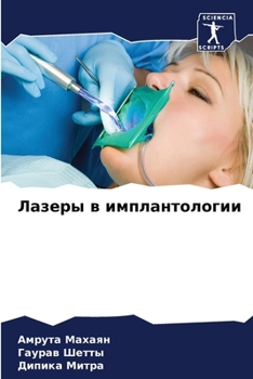 Paperback Лазеры в имплантологии [Russian] Book