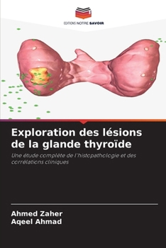Paperback Exploration des lésions de la glande thyroïde [French] Book