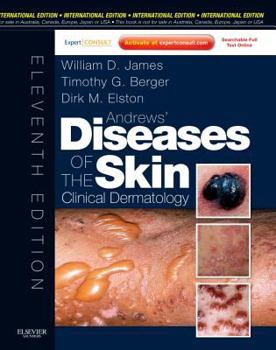 Hardcover [(Andrews' Diseases of the Skin: Clinical Dermatology)] [Author: William D. James] published on (March, 2011) Book