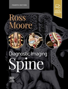 Hardcover Diagnostic Imaging: Spine Book