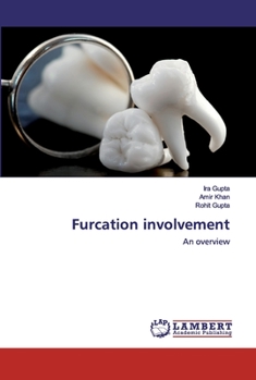 Paperback Furcation involvement Book