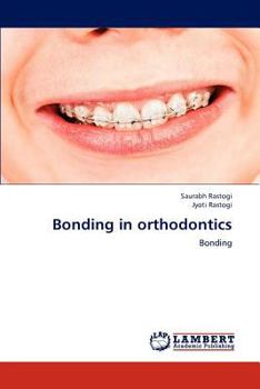 Paperback Bonding in Orthodontics Book