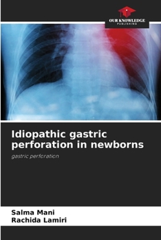 Paperback Idiopathic gastric perforation in newborns Book