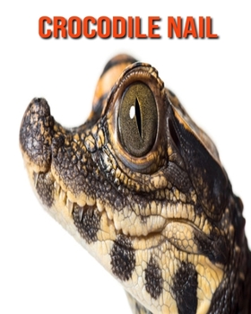 Crocodile Nail: Informations Etonnantes & Images (French Edition)