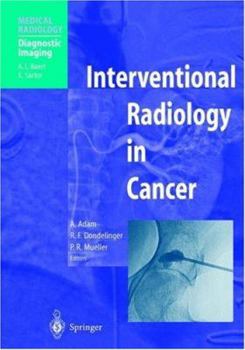 Hardcover Interventional Radiology in Cancer Book