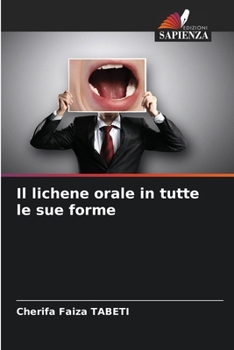 Paperback Il lichene orale in tutte le sue forme [Italian] Book