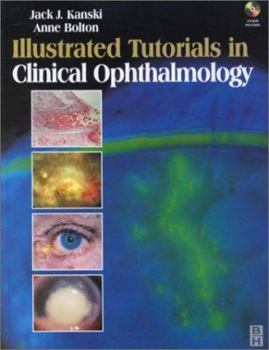 Hardcover Illustrated Tutorials in Clinical Ophthalmology [With CDROM] Book