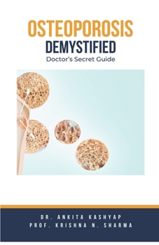 Osteoporosis Demystified: Doctor's Secret Guide