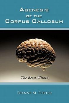 Paperback Agenesis of the Corpus Callosum: The Beast Within Book