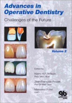 Hardcover Advances in Operative Dentistry, Volume 2: Challenges of the Future Book