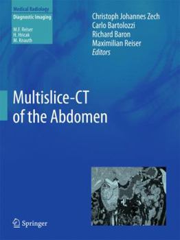 Hardcover Multislice-CT of the Abdomen Book