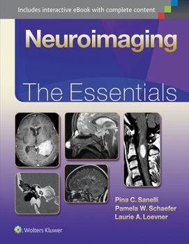 Hardcover Neuroimaging: The Essentials Book