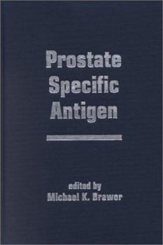 Hardcover Prostate Specific Antigen Book