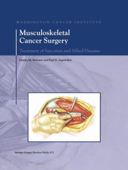 Paperback Musculoskeletal Cancer Surgery: Treatment of Sarcomas and Allied Diseases Book