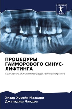 Paperback ПРОЦЕДУРЫ ГАЙМОРОВОГО С& [Russian] Book
