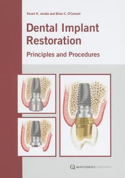 Hardcover Dental Implant Restoration: Principles and Procedures Book