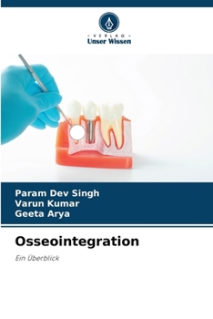 Paperback Osseointegration [German] Book