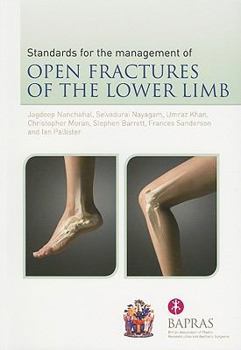 Paperback Standards for the Management of Open Fractures of the Lower Limb Book