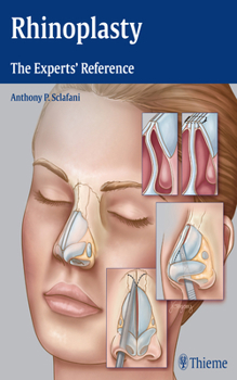 Hardcover Rhinoplasty: The Experts' Reference Book
