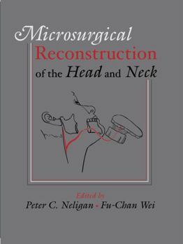 Microsurgical Reconstruction of the Head and Neck