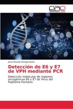 Paperback Detección de E6 y E7 de VPH mediante PCR [Spanish] Book