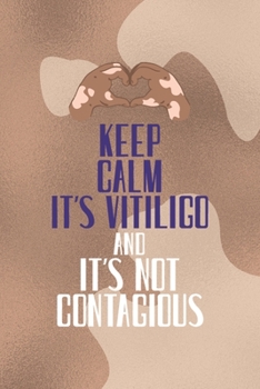 Keep Calm It's Vitiligo And It's Not contagious: Notebook Journal Composition Blank Lined Diary Notepad 120 Pages Paperback Brown Texture Vitiligo
