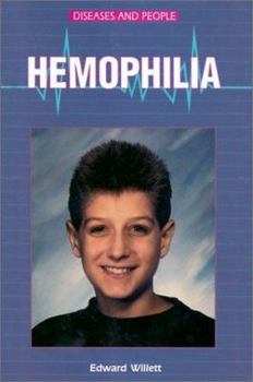 Unknown Binding Hemophilia (Diseases and People) Book