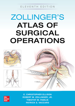 Hardcover Zollinger's Atlas of Surgical Operations, Eleventh Edition Book