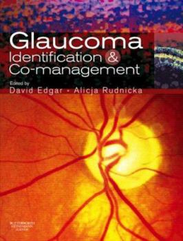 Paperback Glaucoma Identification and Co-management Book